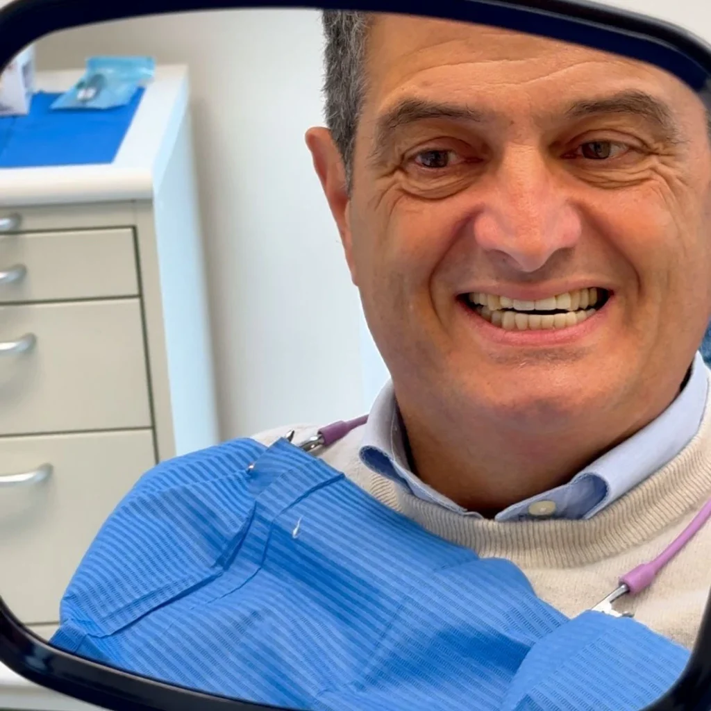 Differenza tra faccette dentali e corone